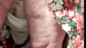 ماں کے علاج کے کھانے کی الرجی کی تنگ بلی کے ساتھ