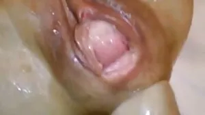 Cassid vomito